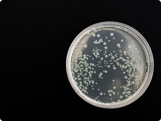 Is jouw ventilatiesysteem broeinest van bacteriƫn en schimmels? Studie biedt uitsluitsel